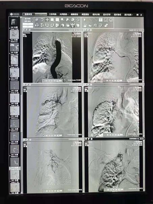 凌晨突发，他毅然做了这个决定