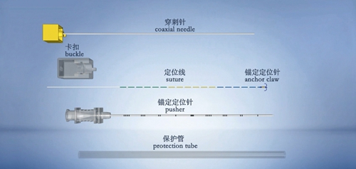 【关注】CT检查：肺小结节大隐患！